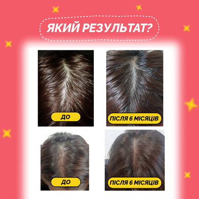 Стимулюючий тонік для росту волосся Dr.FORHAIR Folligen Tonic, 120мл Купити в Україні