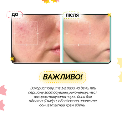 Успокаивающая сыворотка с азелаиновой кислотой 16% Medicube Azelaic Acid 16 BB Calming Serum, 30 мл на KRKR.COM.UA