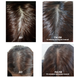 Уцінка Шампунь проти випадіння волосся Dr.FORHAIR Folligen Shampoo, 500мл 88094855310381 фото 11