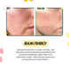 Успокаивающая сыворотка с азелаиновой кислотой 16% Medicube Azelaic Acid 16 BB Calming Serum, 30 мл на KRKR.COM.UA, фото 5