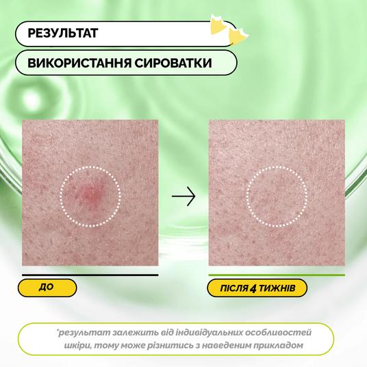 Уцінка Anua Azelaic Acid 3 Cica Skin Clarifying Toner зі знижкою