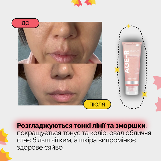 正規品！AGE-R BOOSTER GEL & RED CREAM セット Medicube AGE-R Collagen Booster Gel, 100 мл❤️купить в Киеве, Украина