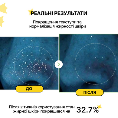 Заспокійливий тонер з екзосомами центели та чайним деревом Medicube Exosome Cica Toner, 210 мл на KRKR.COM.UA