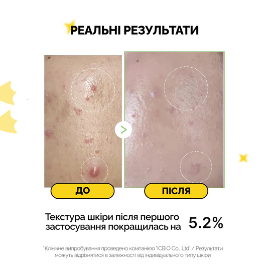 Medicube Exosome Cica Ampoule, 30 мл❤️купить в Киеве, Украина